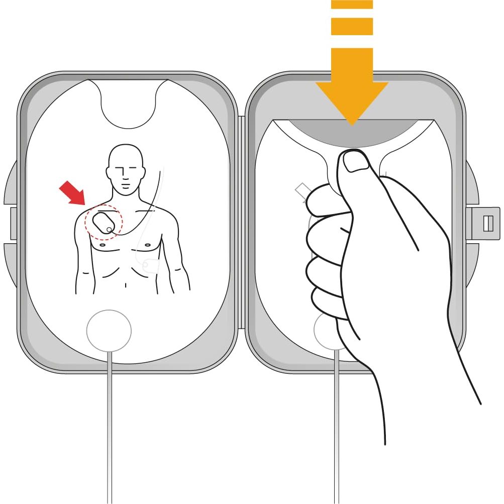 Philips HeartStart FRx SMART Pads II